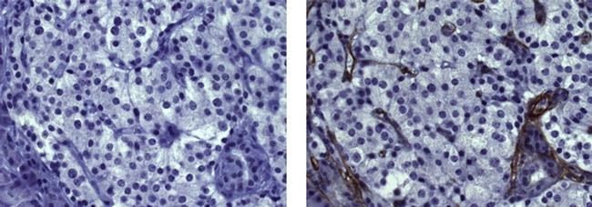 Mouse IgG1 kappa Isotype Control in Immunohistochemistry (Paraffin) (IHC (P))