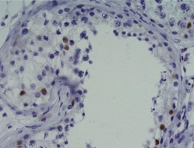 SOX2 Antibody in Immunohistochemistry (Paraffin) (IHC (P))