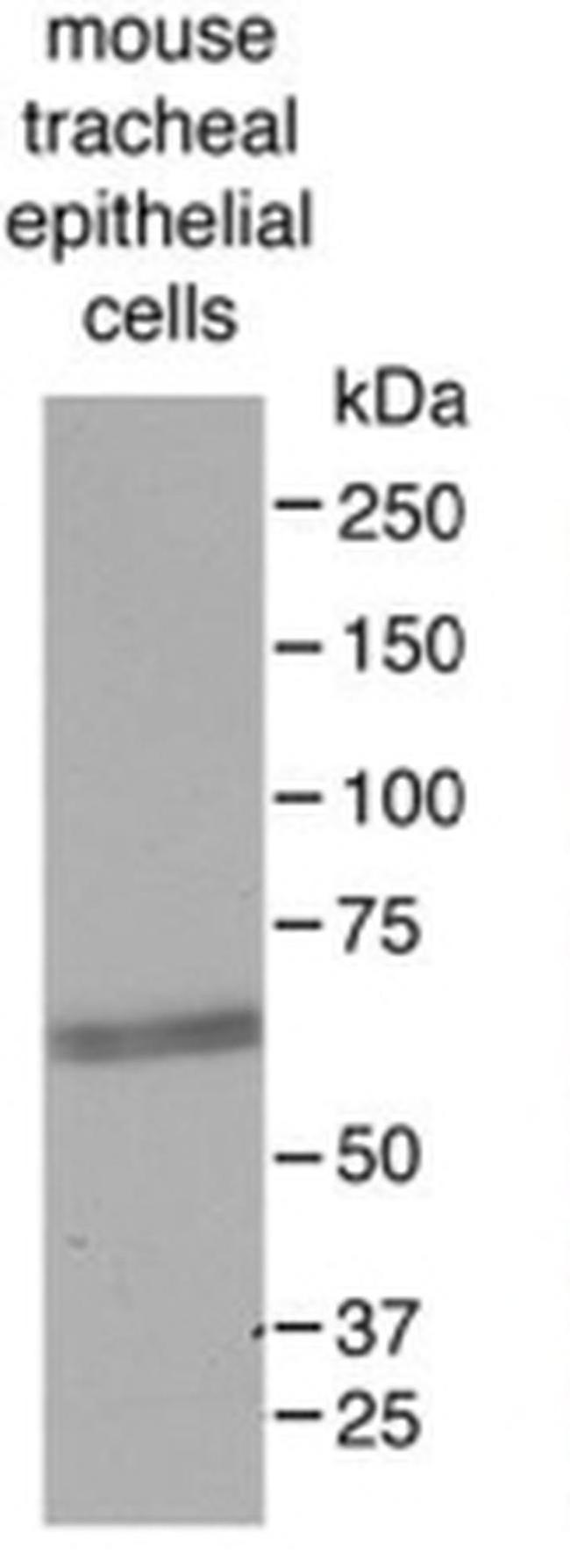 FOXJ1 Antibody in Western Blot (WB)