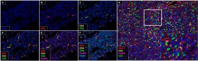 CD4 Antibody in Immunohistochemistry (Paraffin) (IHC (P))