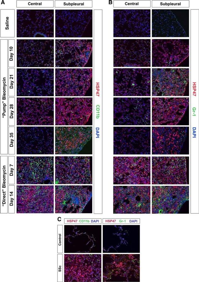 CD11b Antibody in Immunohistochemistry (IHC)