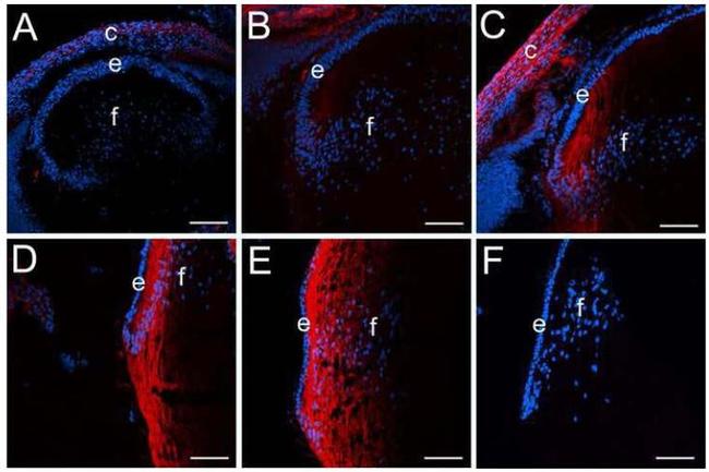 CD44 Antibody in Immunohistochemistry (IHC)