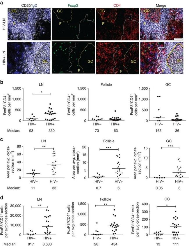 FOXP3 Antibody in Immunohistochemistry (IHC)