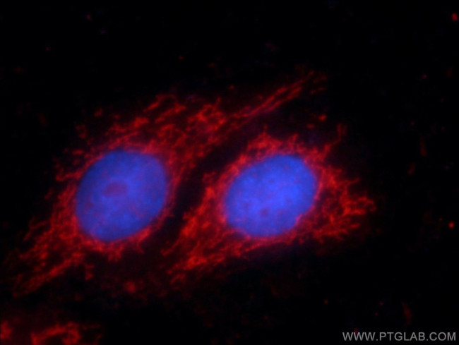 p70(S6K) Antibody in Immunocytochemistry (ICC/IF)