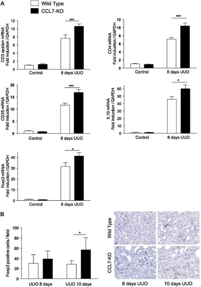 FOXP3 Antibody in Immunohistochemistry (IHC)