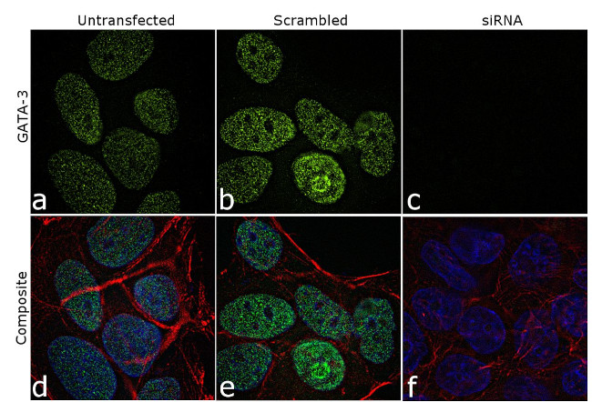 Gata-3 Antibody in Immunocytochemistry (ICC/IF)