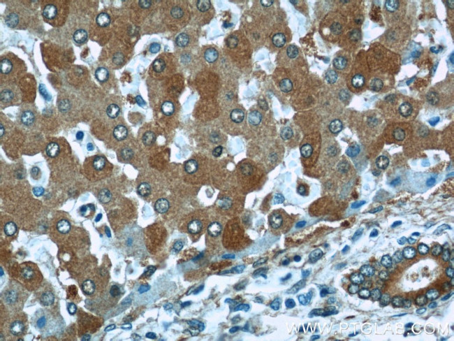 ALDH1A1 Antibody in Immunohistochemistry (Paraffin) (IHC (P))