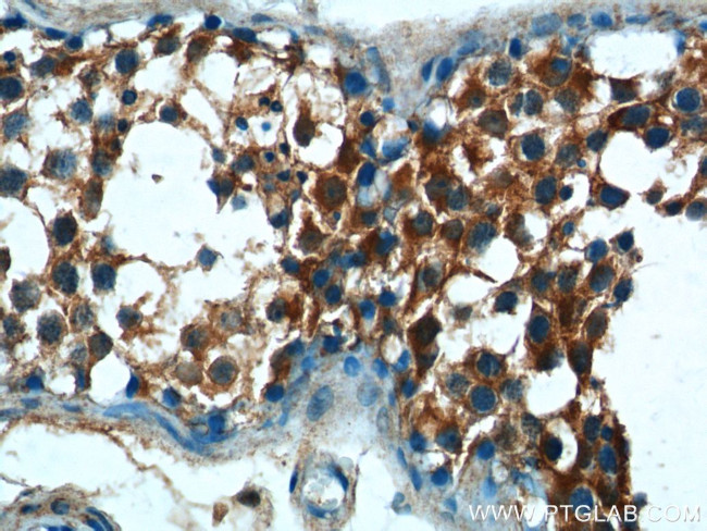 ALDH1A1 Antibody in Immunohistochemistry (Paraffin) (IHC (P))