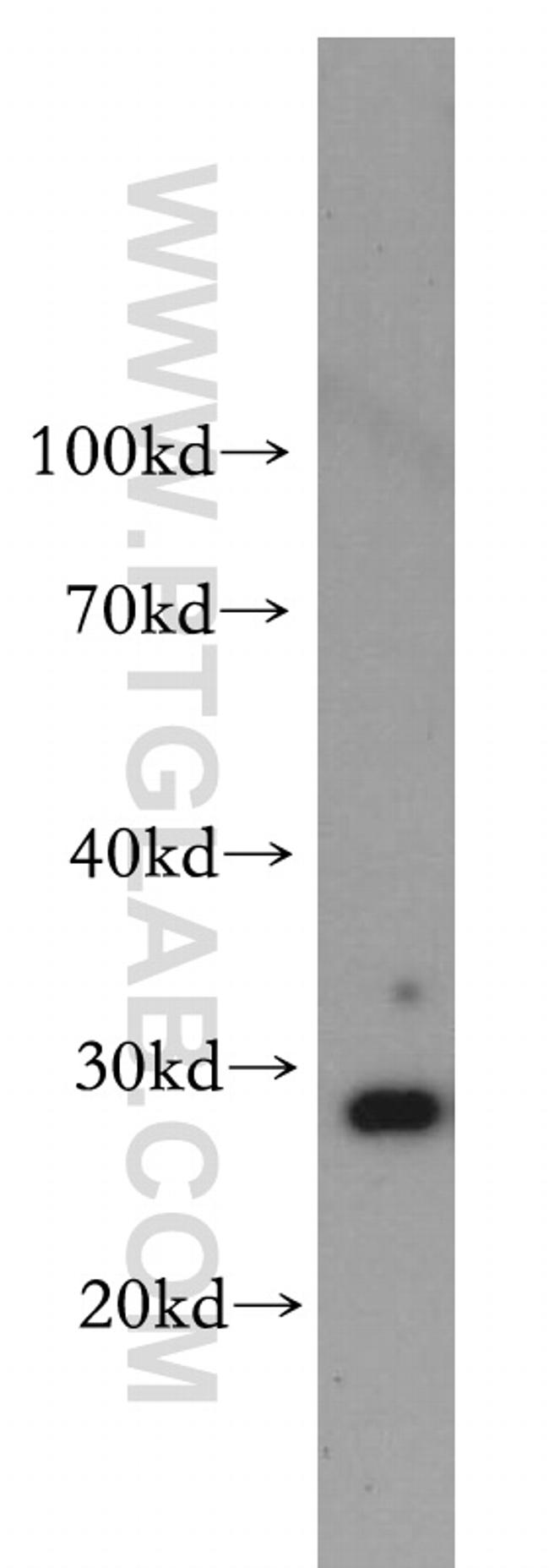 Lin28A Antibody in Western Blot (WB)