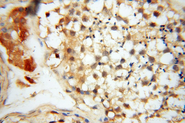 Lin28A Antibody in Immunohistochemistry (Paraffin) (IHC (P))