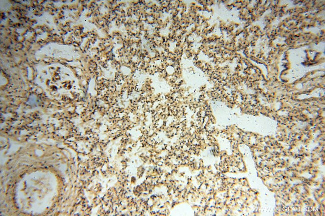 Lin28A Antibody in Immunohistochemistry (Paraffin) (IHC (P))