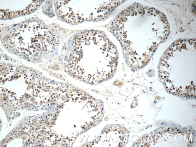 CD244 Antibody in Immunohistochemistry (Paraffin) (IHC (P))