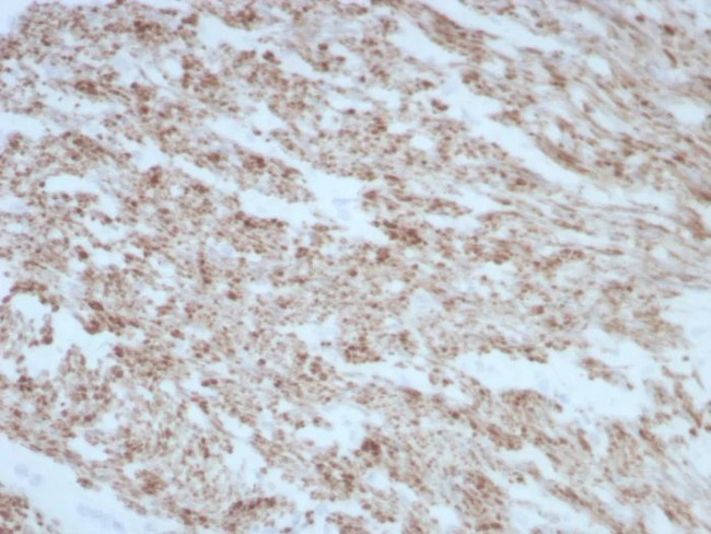 Desmin (Muscle Cell Marker) Antibody in Immunohistochemistry (Paraffin) (IHC (P))