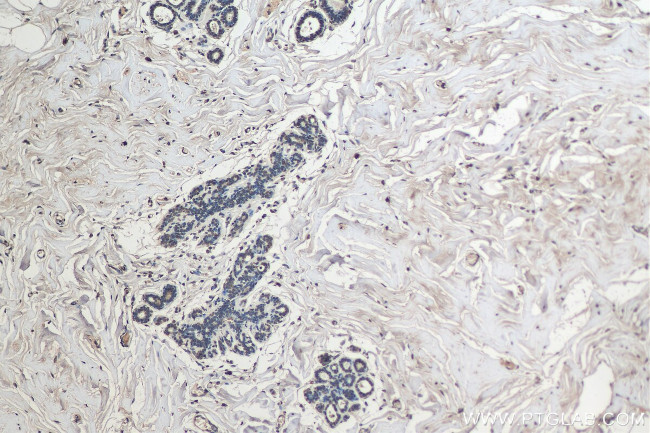 Histone-H3 Antibody in Immunohistochemistry (Paraffin) (IHC (P))