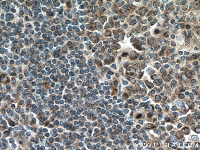 GM-CSF Antibody in Immunohistochemistry (Paraffin) (IHC (P))