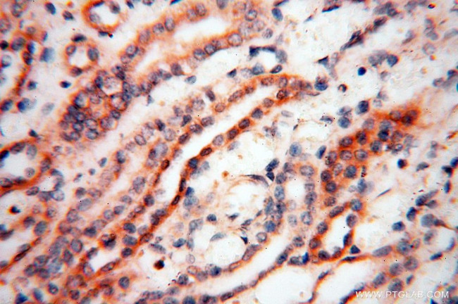 GM-CSF Antibody in Immunohistochemistry (Paraffin) (IHC (P))