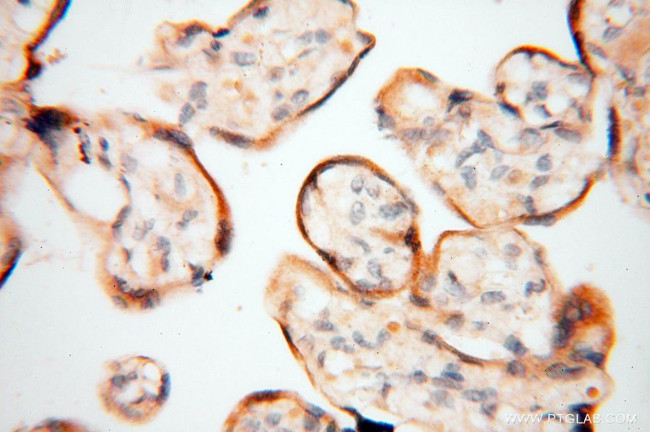 GM-CSF Antibody in Immunohistochemistry (Paraffin) (IHC (P))