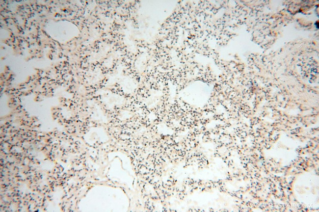 GM-CSF Antibody in Immunohistochemistry (Paraffin) (IHC (P))