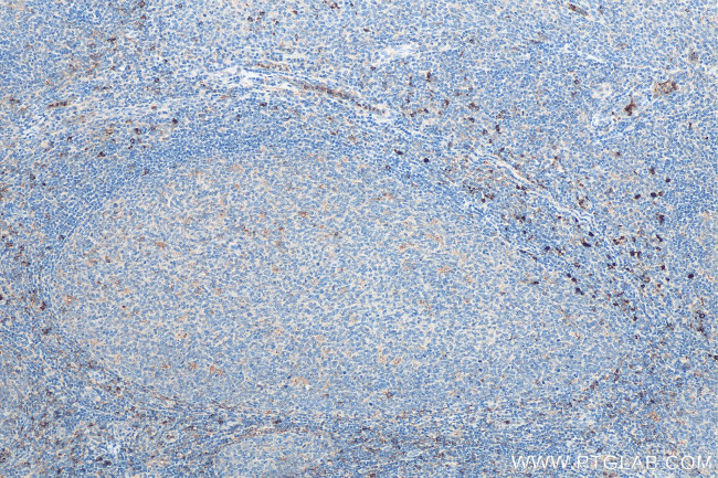 GM-CSF Antibody in Immunohistochemistry (Paraffin) (IHC (P))