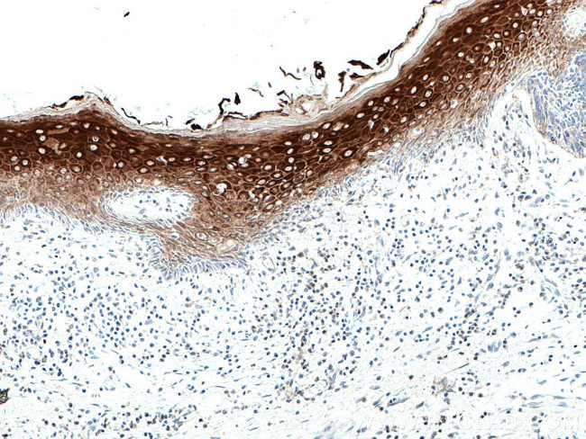 Cytokeratin 10 Antibody in Immunohistochemistry (Paraffin) (IHC (P))