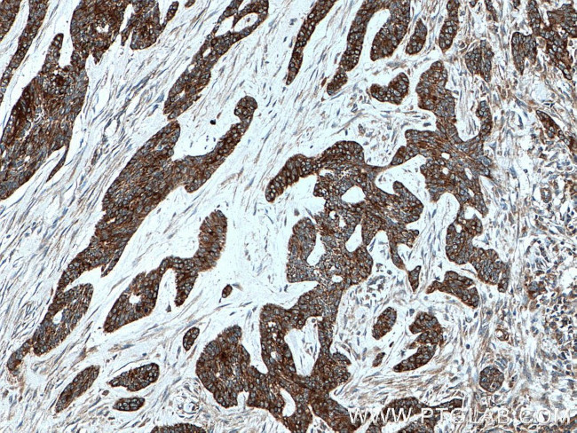 Cytokeratin 10 Antibody in Immunohistochemistry (Paraffin) (IHC (P))