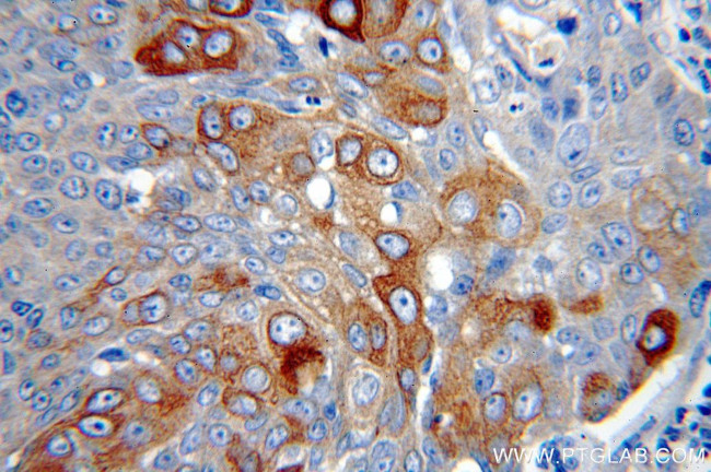 Cytokeratin 10 Antibody in Immunohistochemistry (Paraffin) (IHC (P))