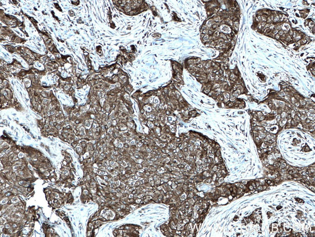 Cytokeratin 10 Antibody in Immunohistochemistry (Paraffin) (IHC (P))