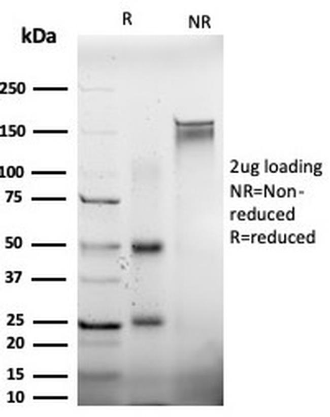 EIF2S1/EIF-2 alpha (EIF2A) Antibody in SDS-PAGE (SDS-PAGE)