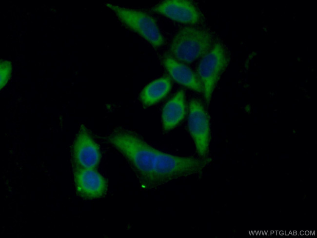 Collagen Type IV Antibody in Immunocytochemistry (ICC/IF)