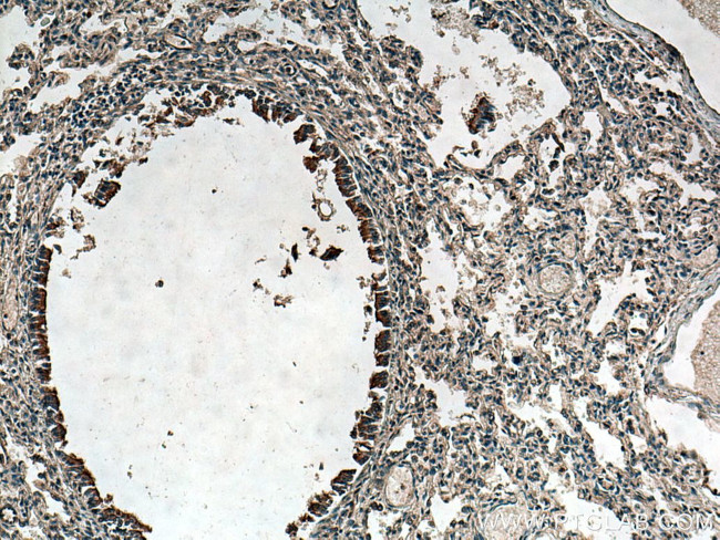 CFTR Antibody in Immunohistochemistry (Paraffin) (IHC (P))