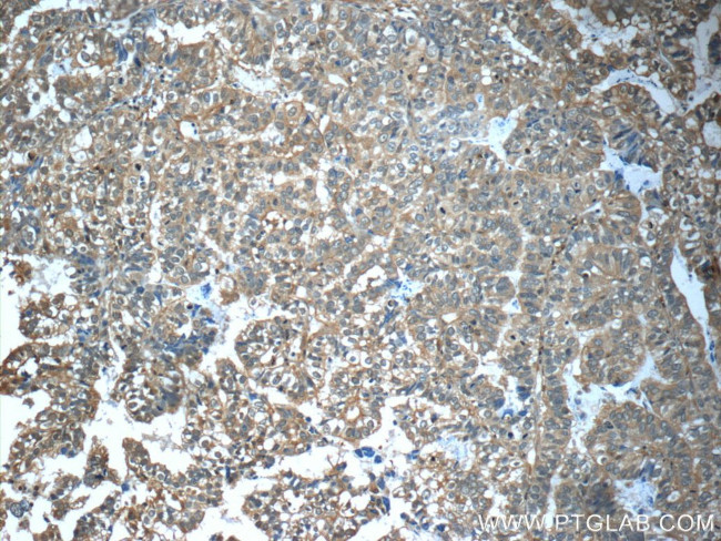 CFTR Antibody in Immunohistochemistry (Paraffin) (IHC (P))