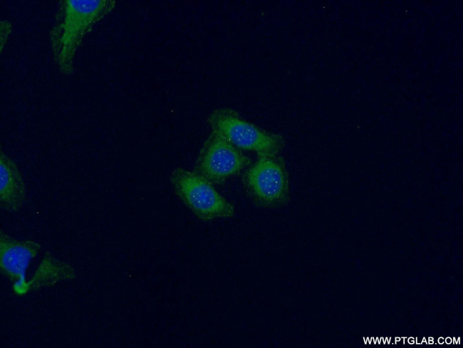 Claudin 18 Antibody in Immunocytochemistry (ICC/IF)