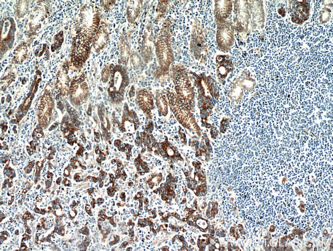 Claudin 18 Antibody in Immunohistochemistry (Paraffin) (IHC (P))