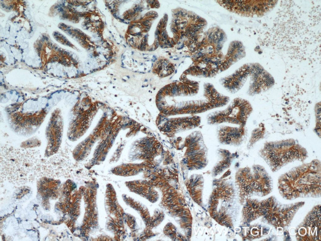 Claudin 18 Antibody in Immunohistochemistry (Paraffin) (IHC (P))