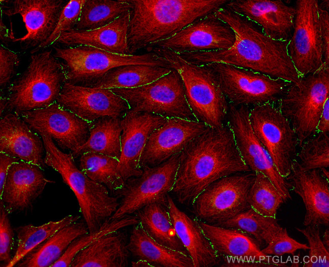 ZO-1 Antibody in Immunocytochemistry (ICC/IF)