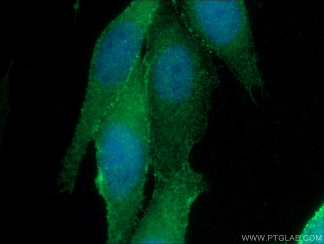 ZO-1 Antibody in Immunocytochemistry (ICC/IF)