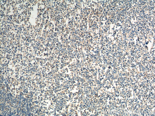 CCR3 Antibody in Immunohistochemistry (Paraffin) (IHC (P))