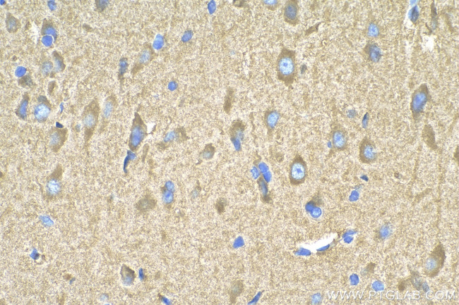 SYNJ1 Antibody in Immunohistochemistry (Paraffin) (IHC (P))