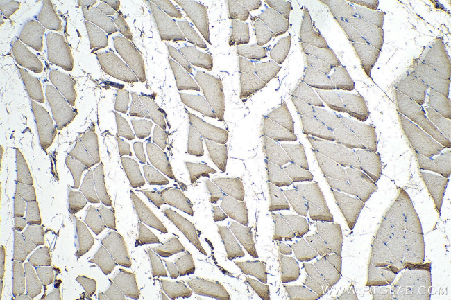 SYNJ1 Antibody in Immunohistochemistry (Paraffin) (IHC (P))