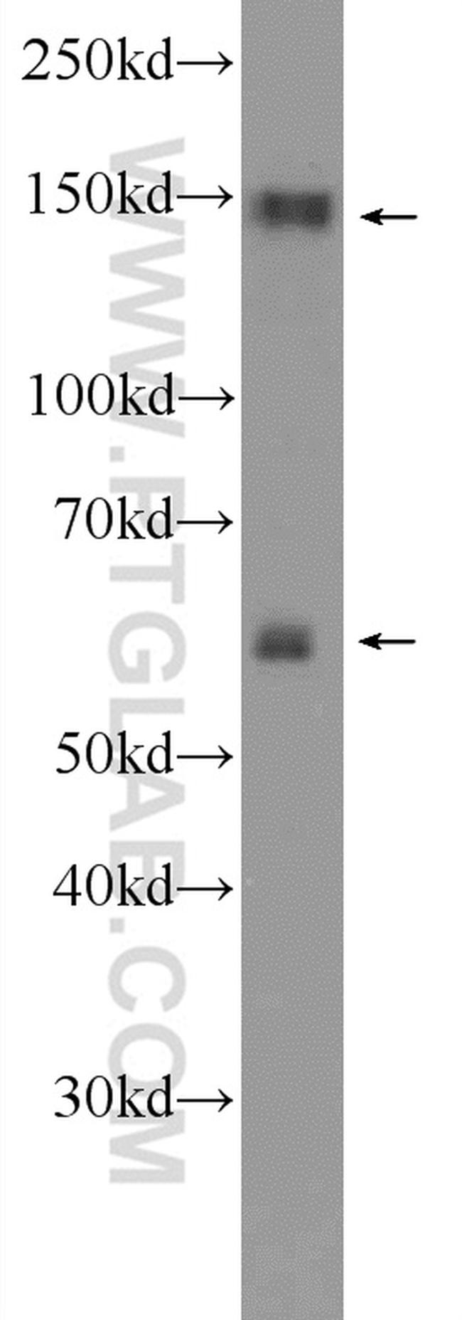 SYNJ1 Antibody in Western Blot (WB)