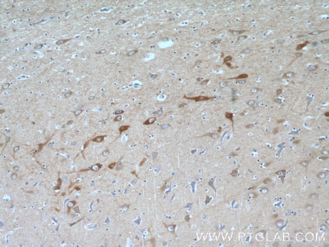 SYNJ1 Antibody in Immunohistochemistry (Paraffin) (IHC (P))