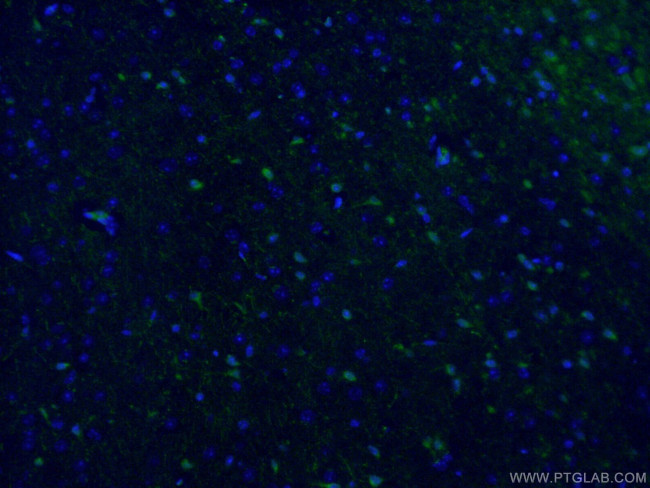 ATG9A Antibody in Immunohistochemistry (PFA fixed) (IHC (PFA))