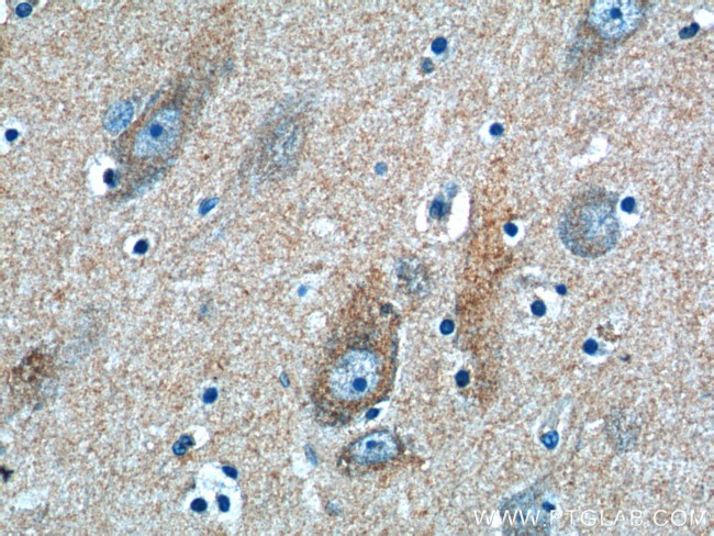 ATG9A Antibody in Immunohistochemistry (Paraffin) (IHC (P))