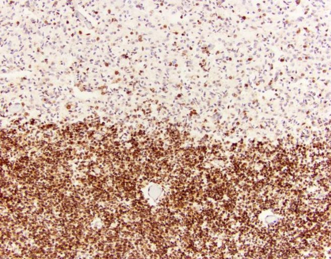 Mouse IgG (H+L) Secondary Antibody in Immunohistochemistry (Paraffin) (IHC (P))