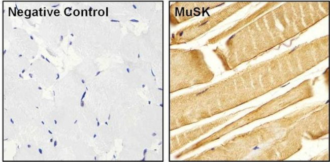 Rabbit IgG (H+L) Secondary Antibody in Immunohistochemistry (Paraffin) (IHC (P))