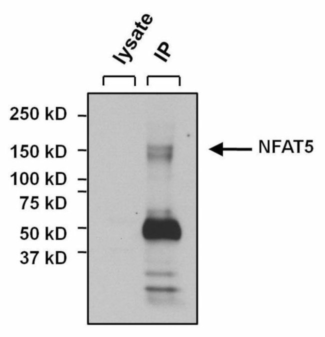 Rabbit IgG (H+L) Secondary Antibody in Immunoprecipitation (IP)