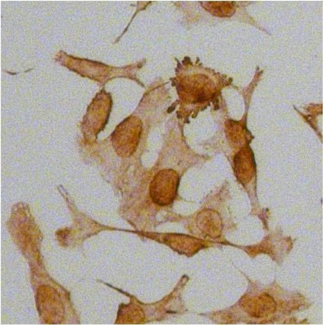 Rabbit IgG (H+L) Secondary Antibody in Immunocytochemistry (ICC/IF)