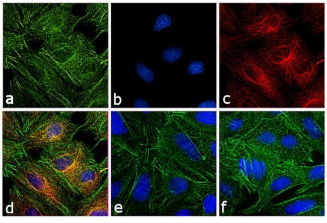 Rat IgG (H+L) Secondary Antibody in Immunocytochemistry (ICC/IF)