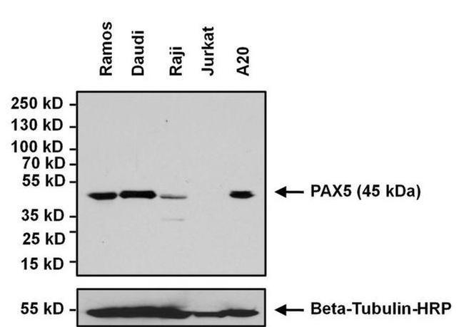 Rabbit IgG (H+L) Secondary Antibody in Western Blot (WB)