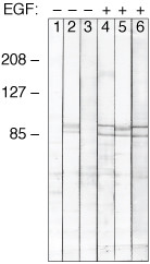 Phospho-STAT1 (Tyr701) Antibody in Western Blot (WB)